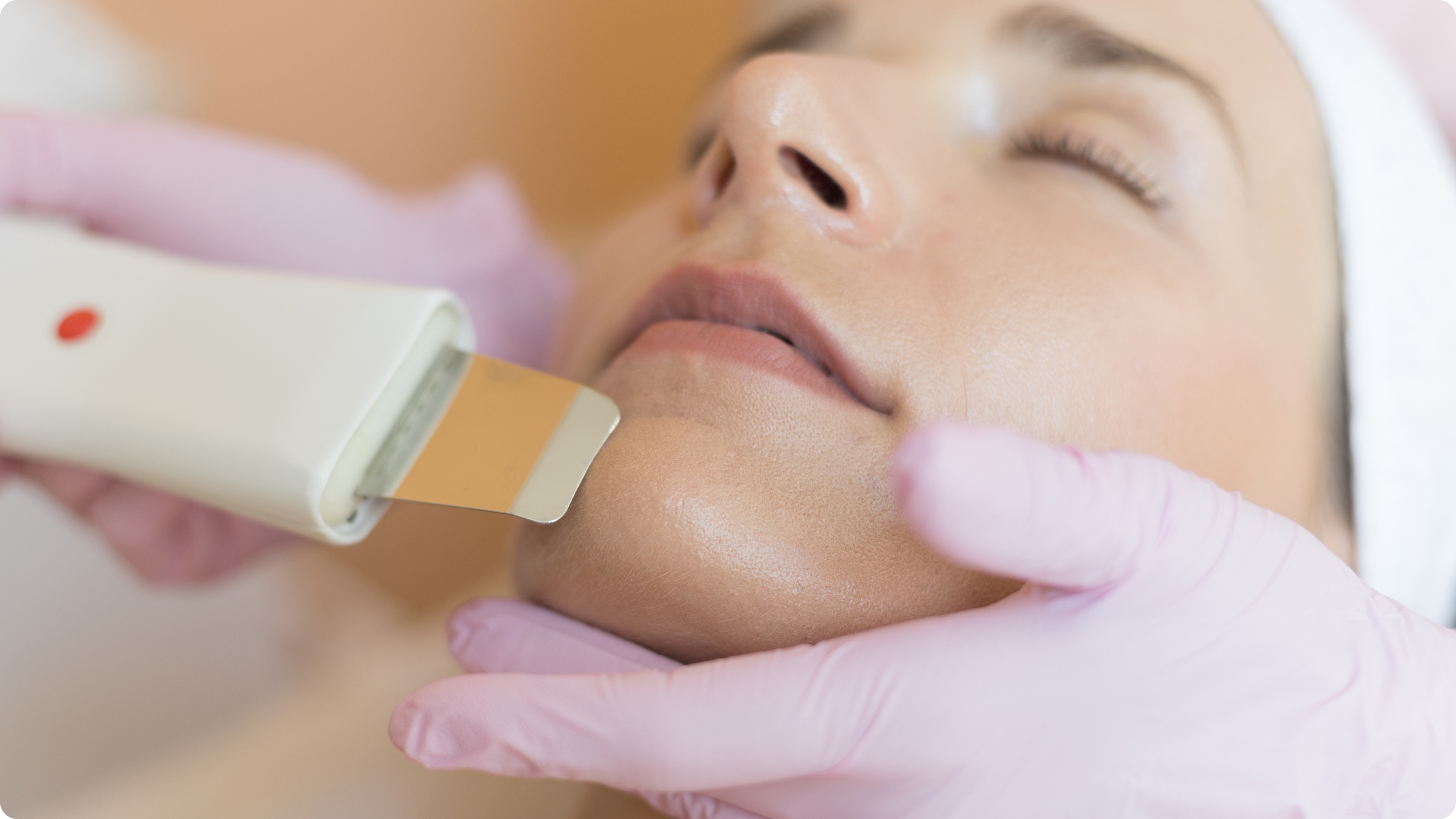 Peeling kawitacyjny pricing